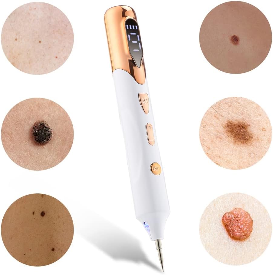 Laser Mole Removal Pen | Plasma Wart, Freckle, Skin Tag & Tattoo Spot Remover Tool | Electric Beauty Skin Care Device